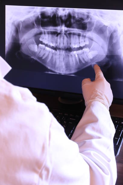Best Emergency Root Canal Therapy in Morrisonvle, IL